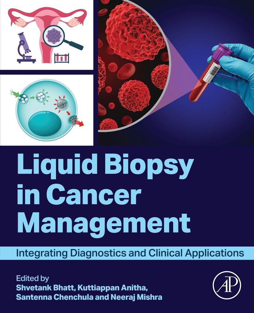 Liquid biopsy in Cancer Management