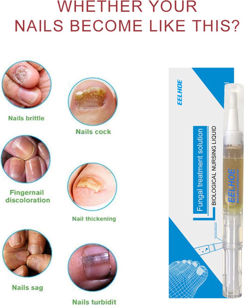 Nagelpflegeöl 18ml - Behandlung Für Fingernägel & Fußnägel Mit Pinselapplikator
