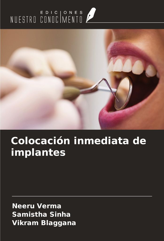 Colocación inmediata de implantes