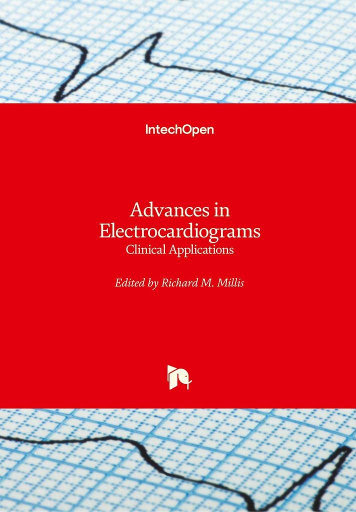 Advances in Electrocardiograms