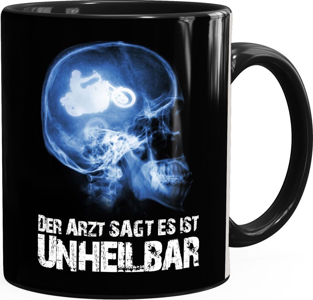 Kaffee-Tasse Xray Der Arzt sagt es ist unheilbar Hobby Schädel Röntgenbild Biker Motorrad Chopper Motorradfahrer Geschenk-Tasse Moonworks schwa...