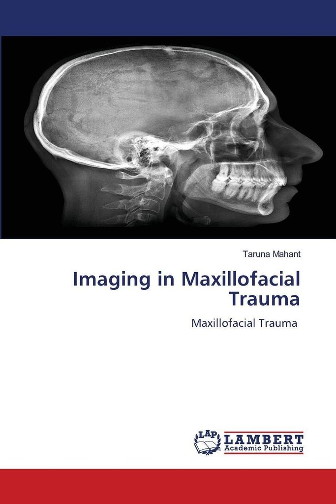 Imaging in Maxillofacial Trauma