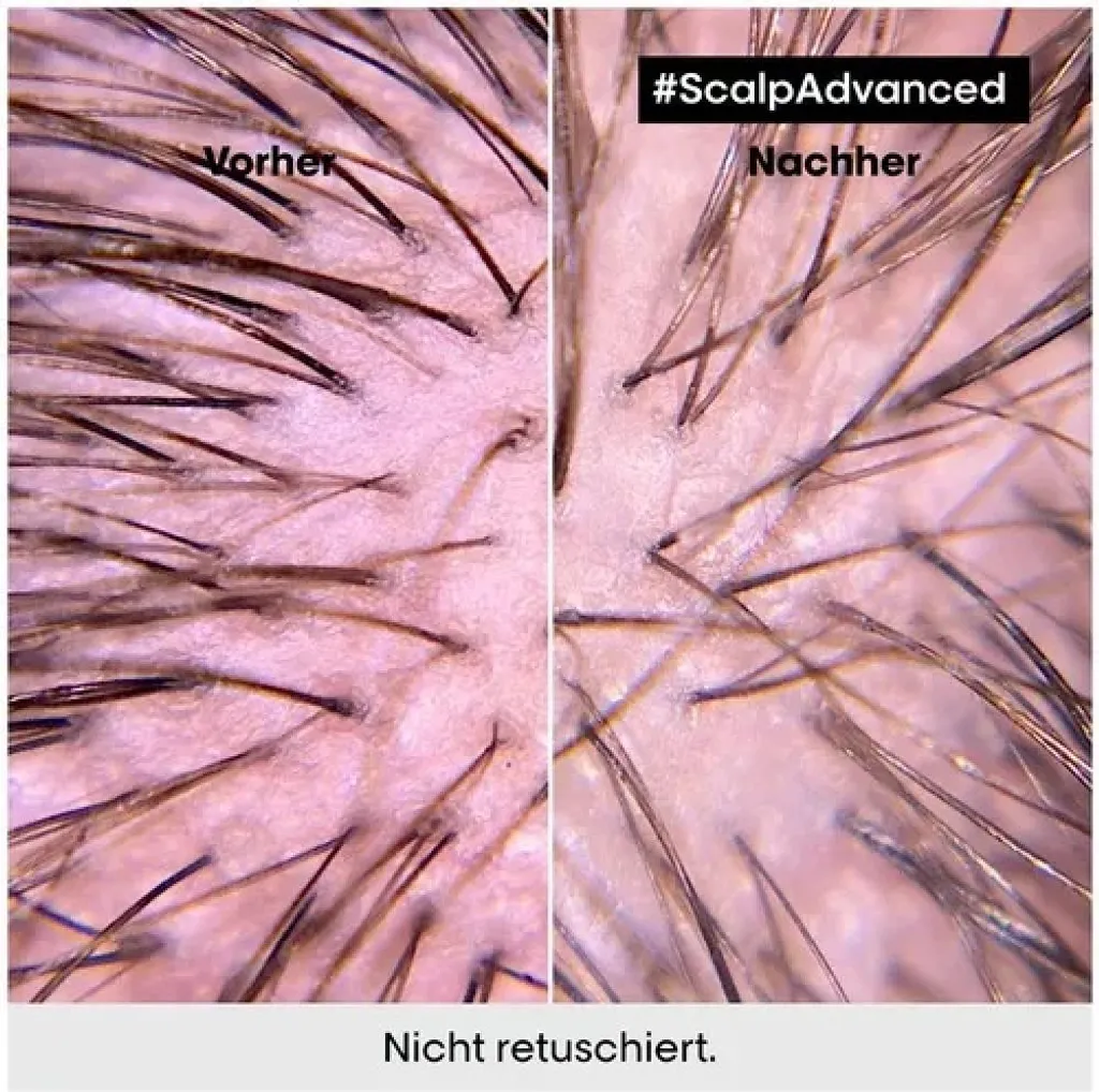 L'Oréal Serie Expert Scalp Advanced 500ml: Spa per la tua Cute - 16