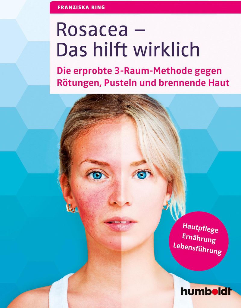 Rosacea - Das hilft wirklich