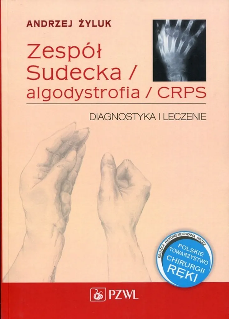 Traitement CRPS et Algodystrophie : Attelle de Repos Zespół Sudecka