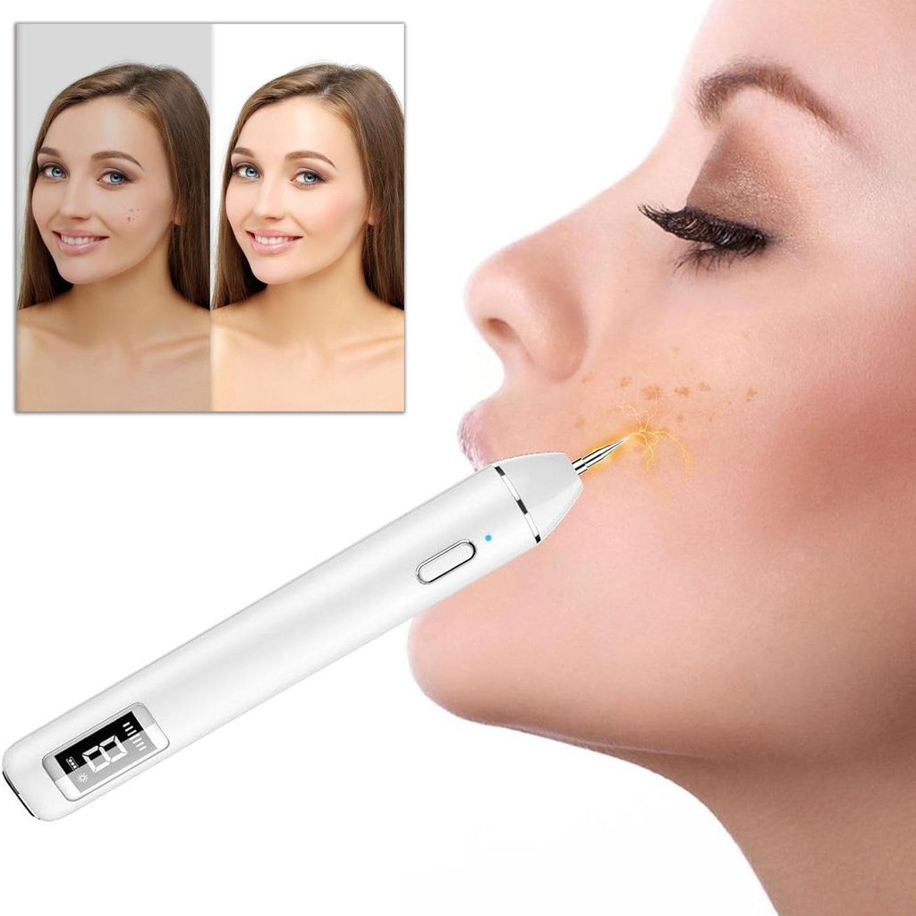 OKWISH Hautmarker Stift Laser Plasma Mückenentferner Set Produktbild 