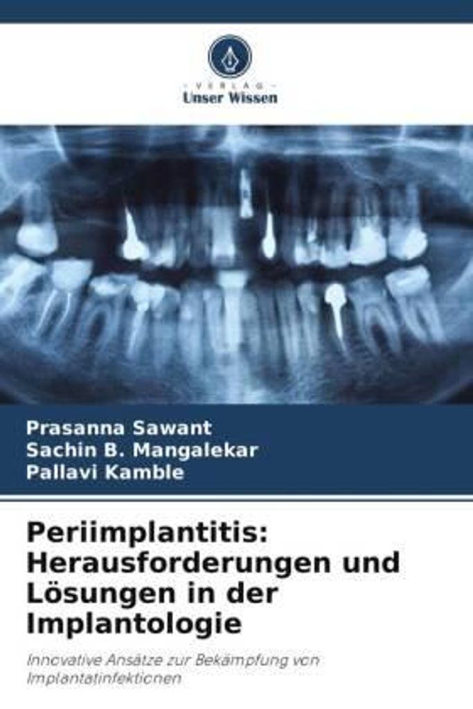 Periimplantitis: Herausforderungen und Lösungen in der Implantologie