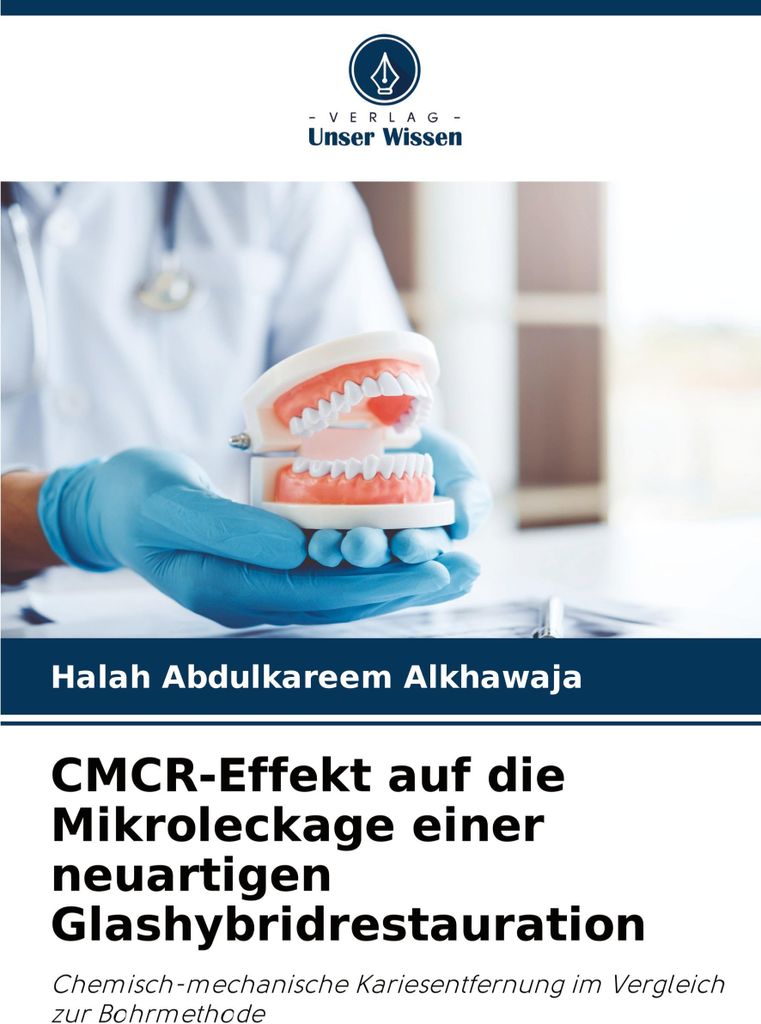 CMCR-Effekt auf die Mikroleckage einer neuartigen Glashybridrestauration