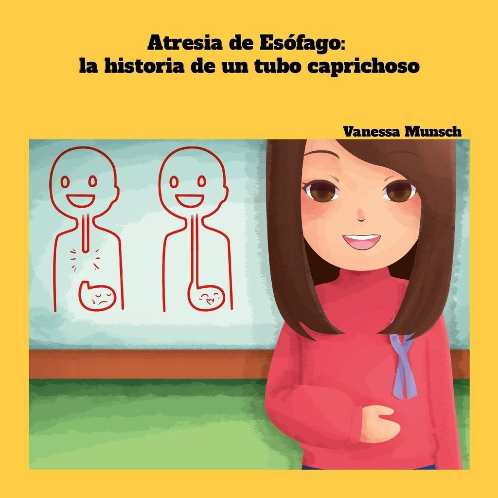 Atresia de Esófago