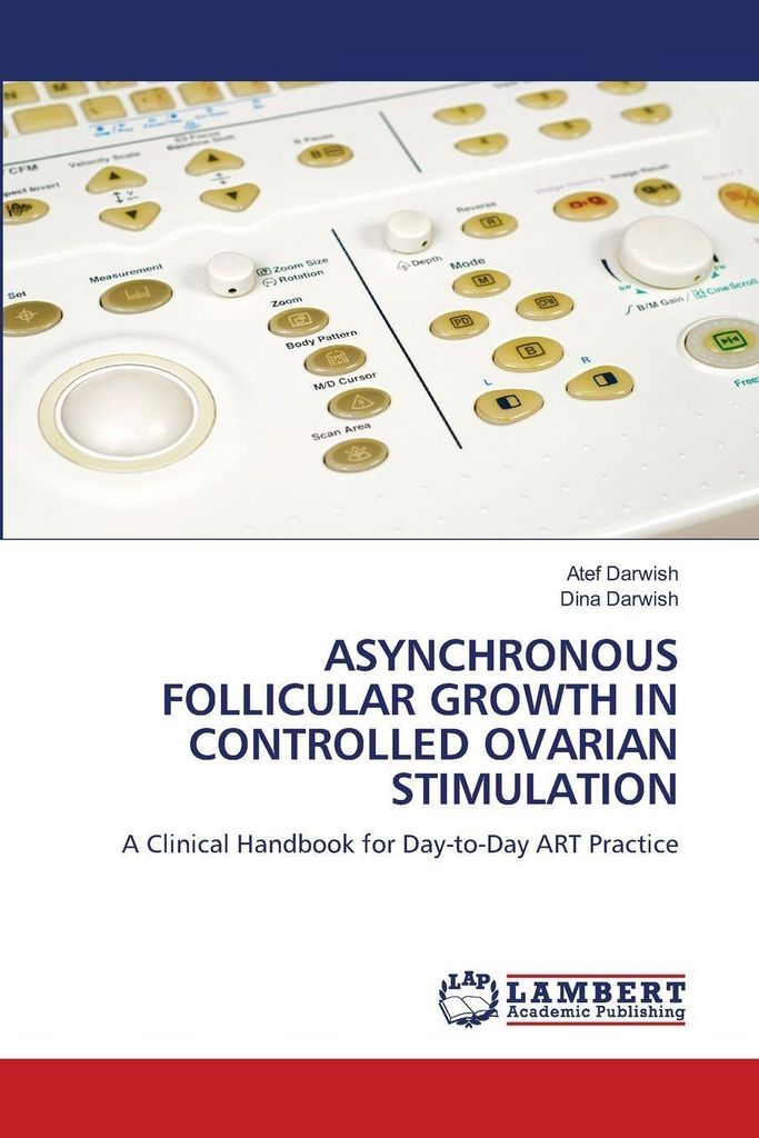 Asynchronous Follicular Growth In Controlled Ovarian Stimulation