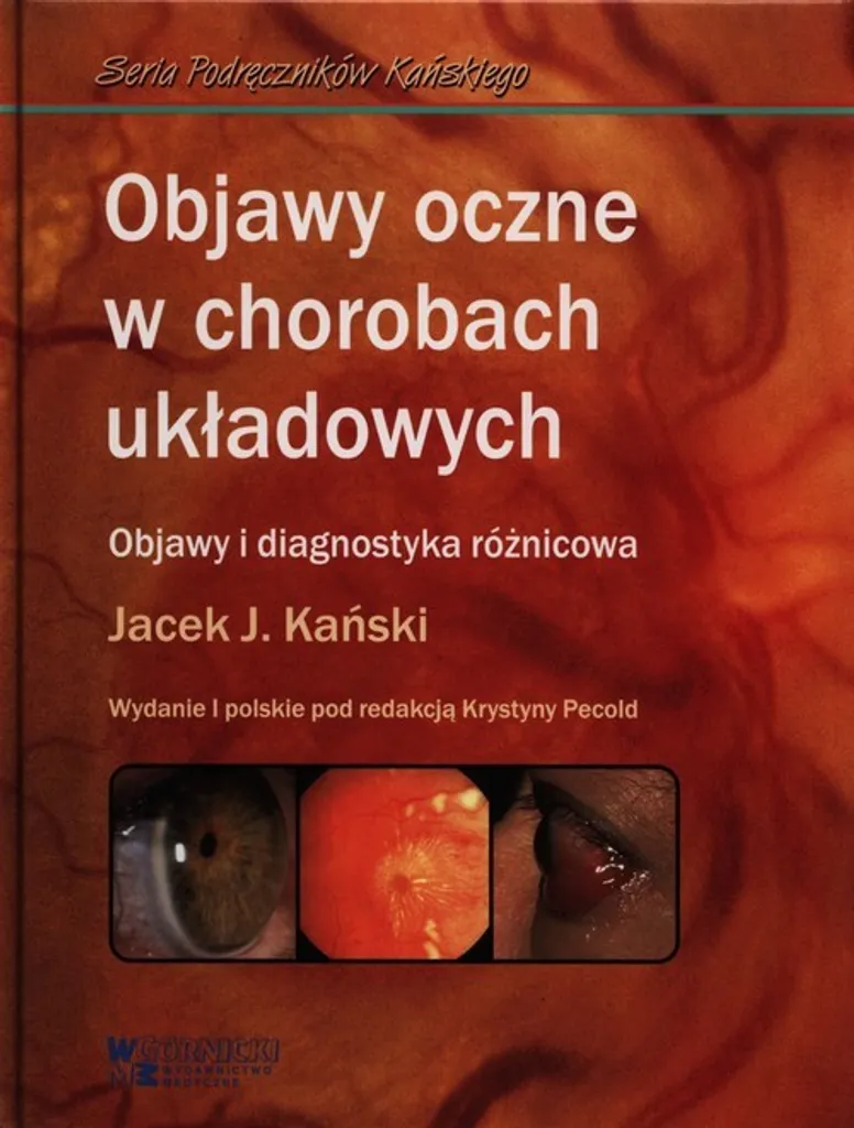 Manifestations oculaires dans les maladies systémiques - Guide complet