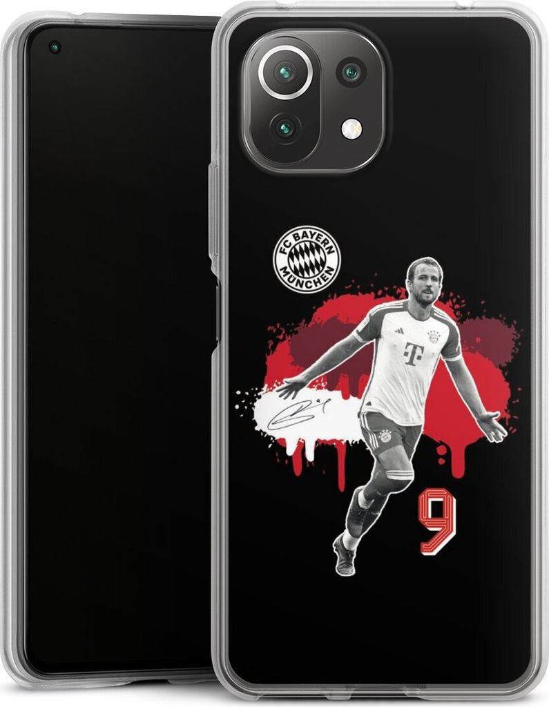 DeinDesign Handyhülle für Xiaomi Mi 11 Lite 5G NE Silikon Hülle Case Smartphone Schutzhülle FC Bayern München Offizielles Lizenzprodukt Harry ...