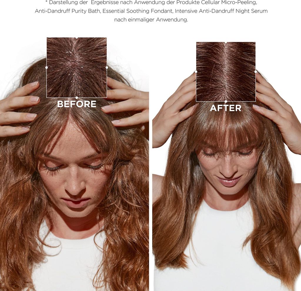 Kérastase Symbiose Moisturising Anti-Dandruff Cellular Produktbild 3