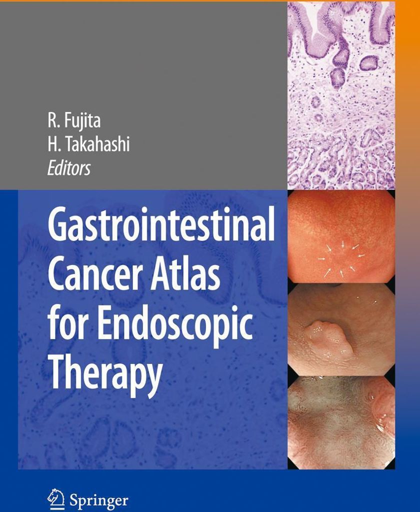 Gastrointestinal Cancer Atlas for Endoscopic Therapy