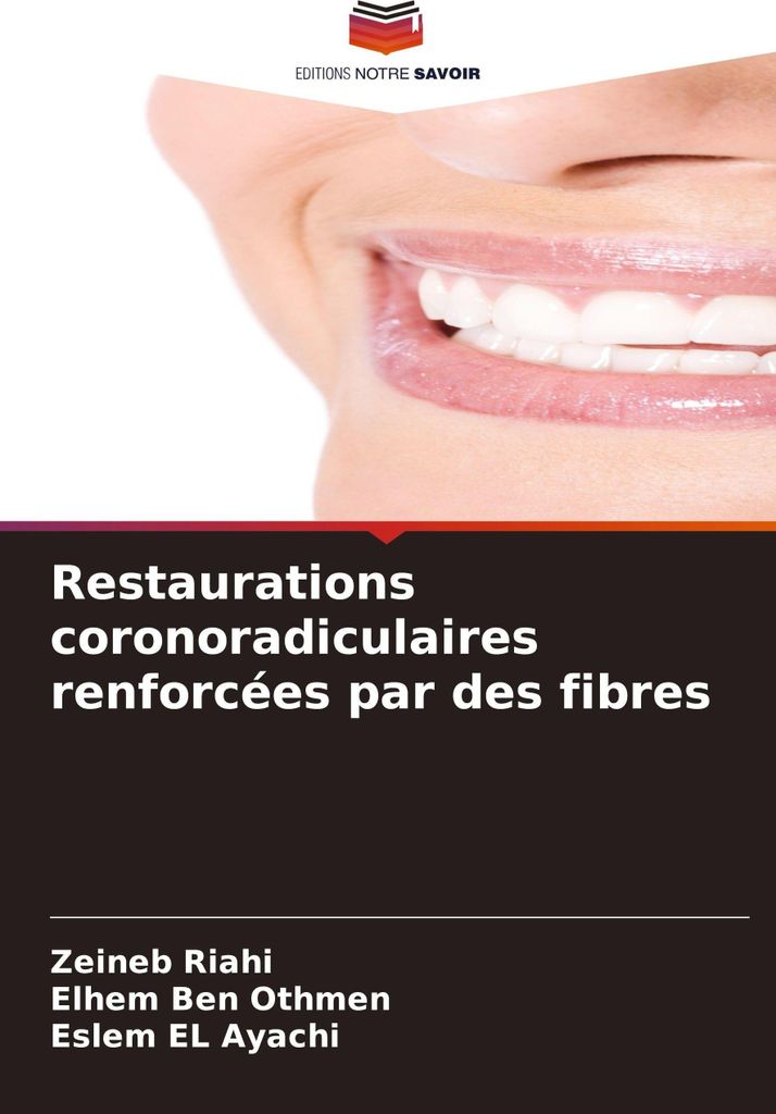 Restaurations coronoradiculaires renforcées par des fibres
