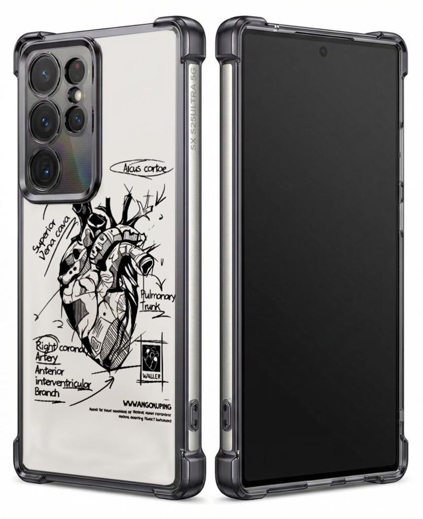 Personalisierte Hülle mit Bild für Samsung Galaxy S24+ Elektroplattiert TPU Stoßdämpfer Handyhülle mit Anatomisches Herzdiagramm zum Ausdrucken
