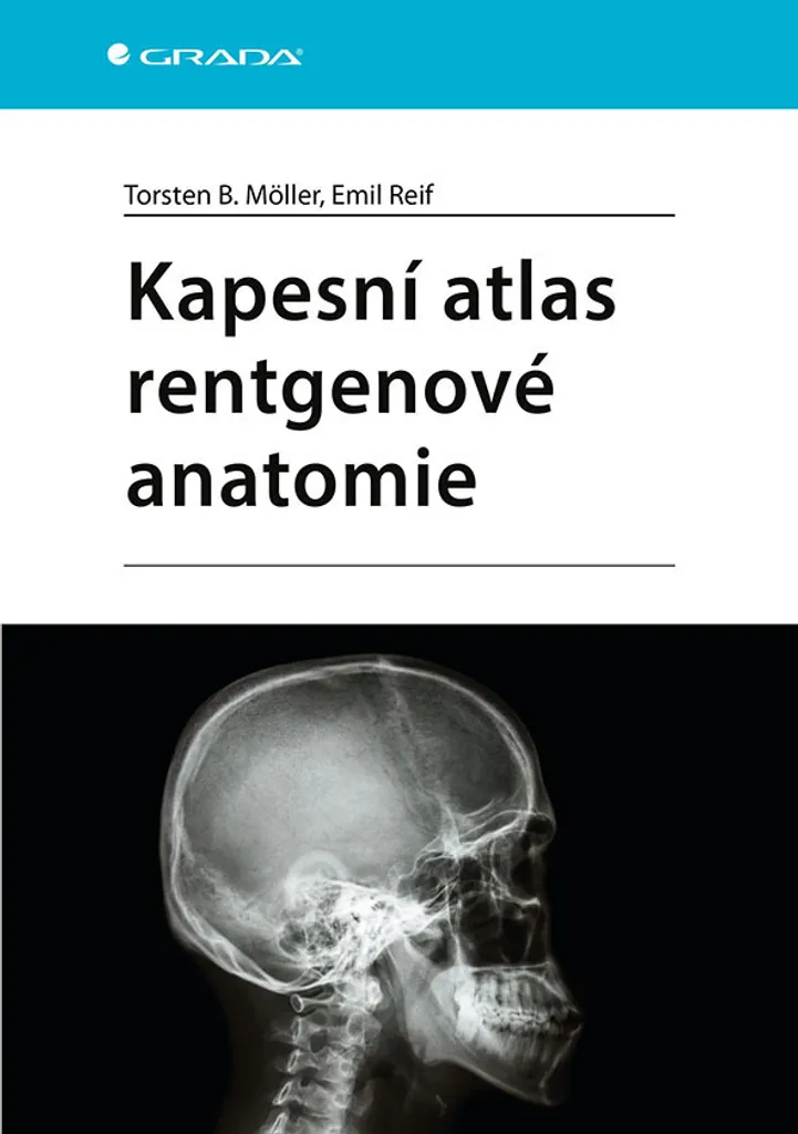 Identifier les structures sur radio et scanner avec l'atlas de Möller