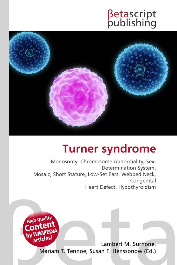Turner syndrome