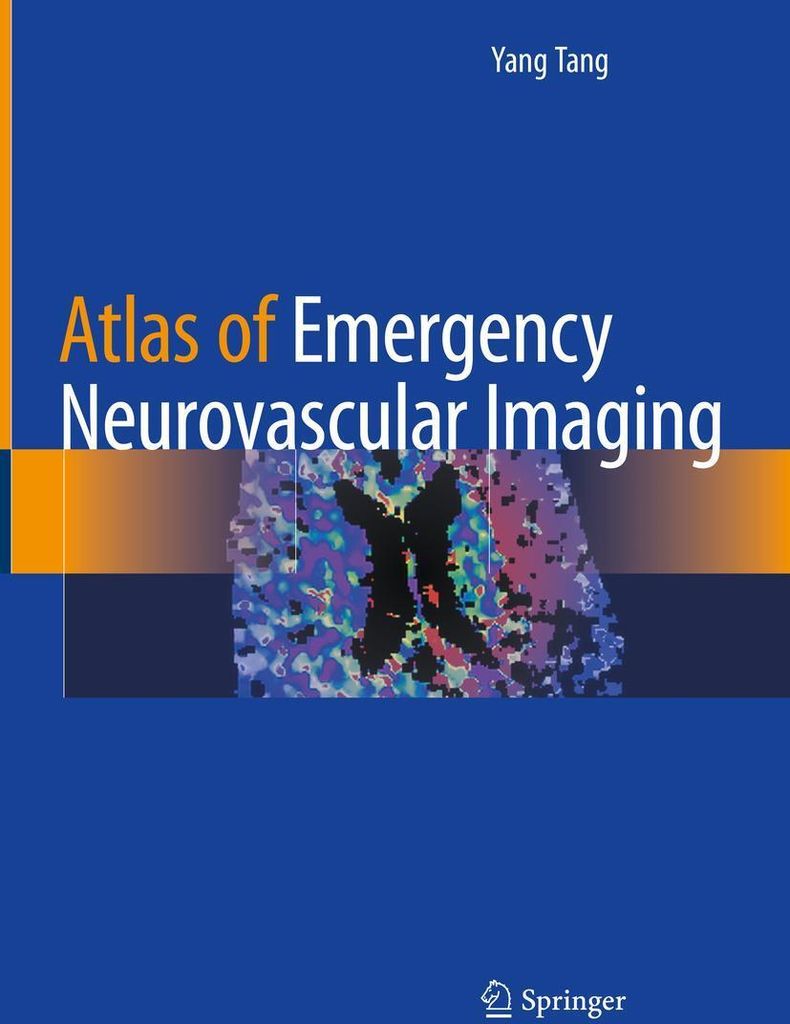 Atlas of Emergency Neurovascular Imaging