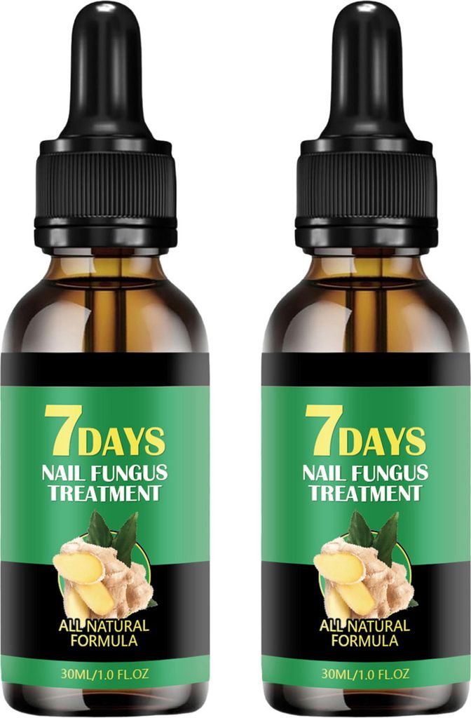 30 ml Nagelwachstumsserum Ingwer-Nagelbehandlung Nagelwachstumsreparatur Ätherische Öle Natürliches sicheres Nagelhautpflegeöl für Nägel Befe...