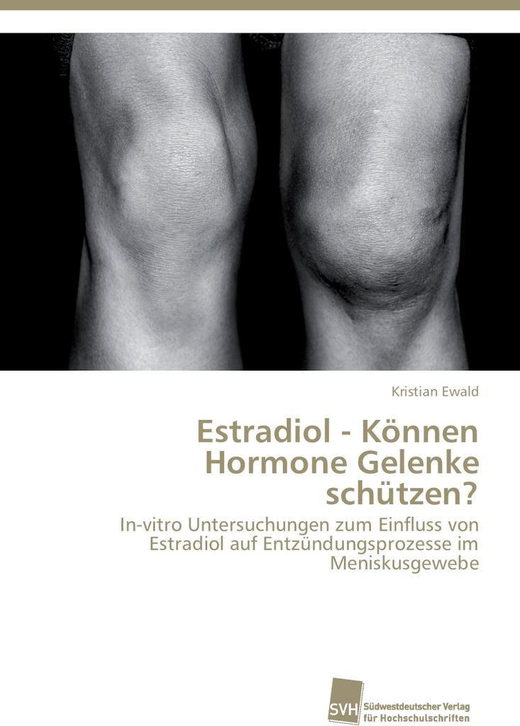 Estradiol - Können Hormone Gelenke schützen?