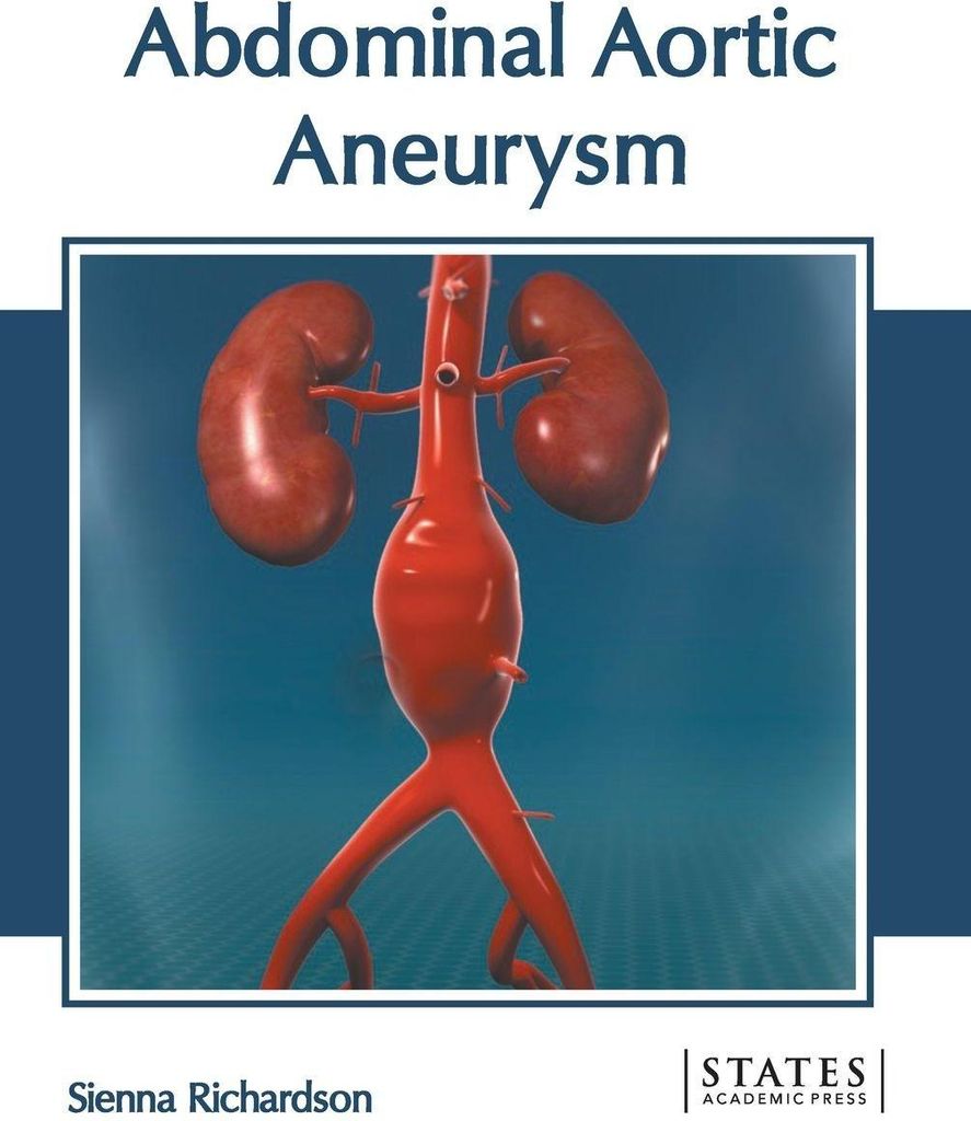 Abdominal Aortic Aneurysm