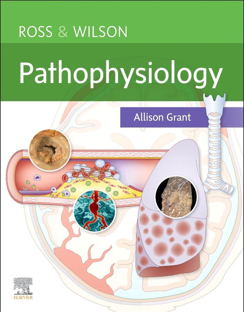 Ross Wilson Pathophysiology – Lingua: Inglese