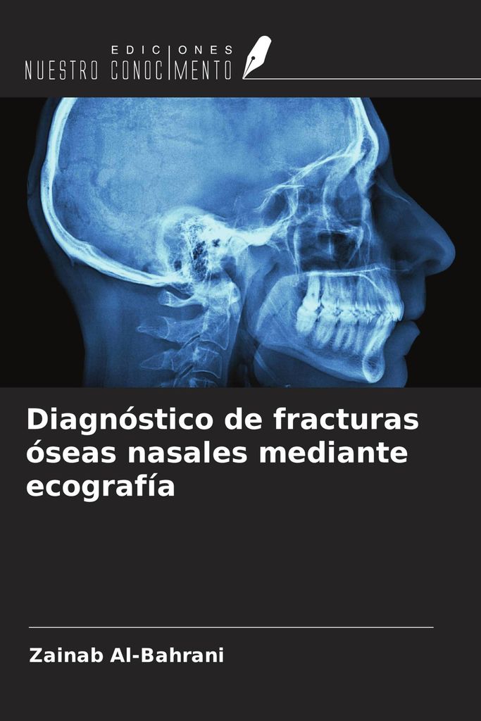 Diagnóstico de fracturas óseas nasales mediante ecografía