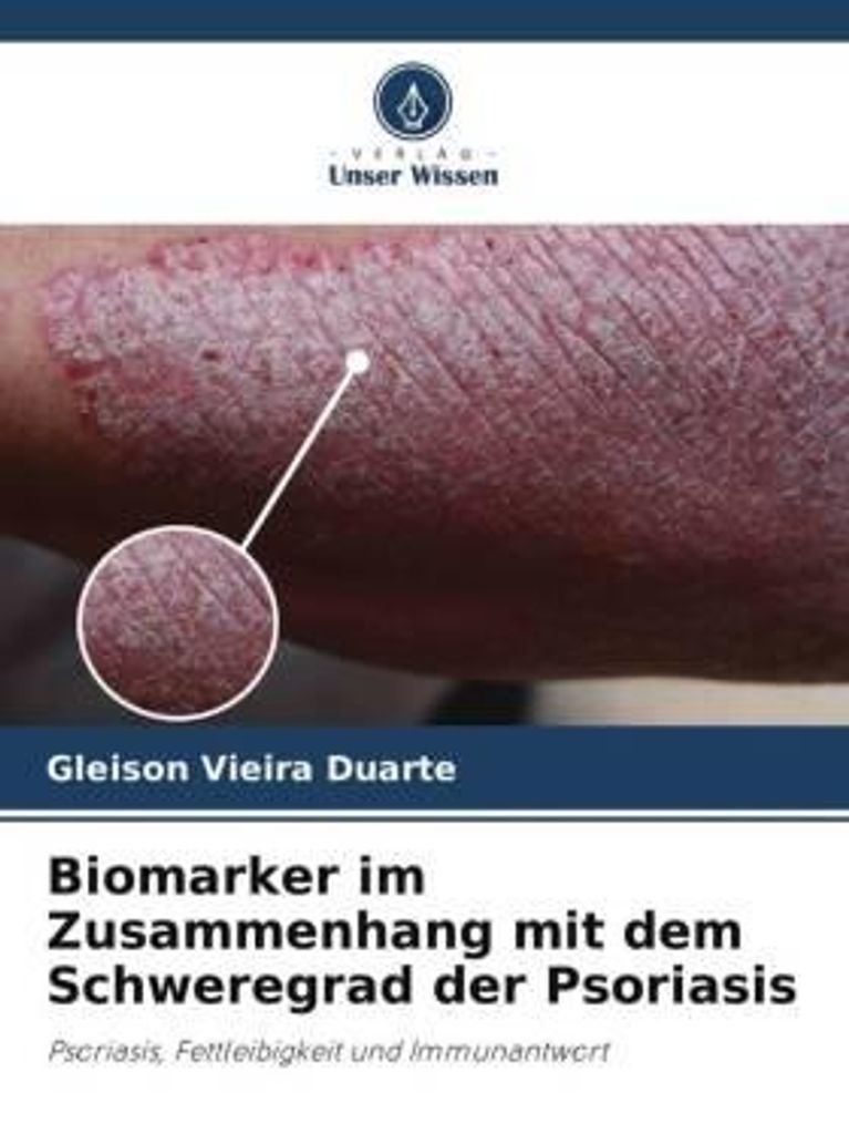 Biomarker im Zusammenhang mit dem Schweregrad der Psoriasis