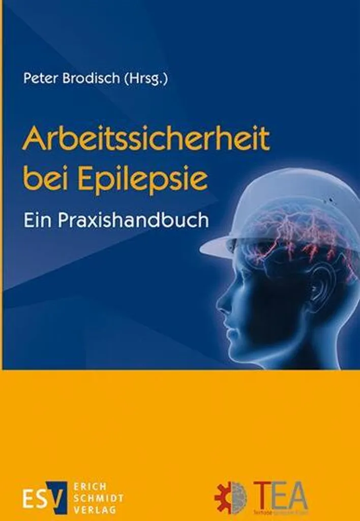 Épilepsie et Travail : Guide Pratique d'Aménagement de Poste Sécurisé