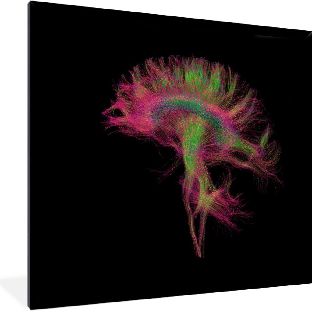 MuchoWow® Gerahmtes Poster MRI-Scan 40x40 cm - Poster mit Produktbild 