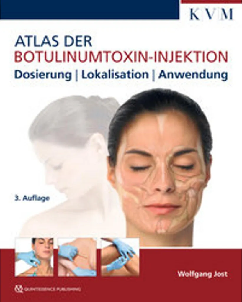 Atlas der Botulinumtoxin-Injektion avec illustrations 3D et points clés