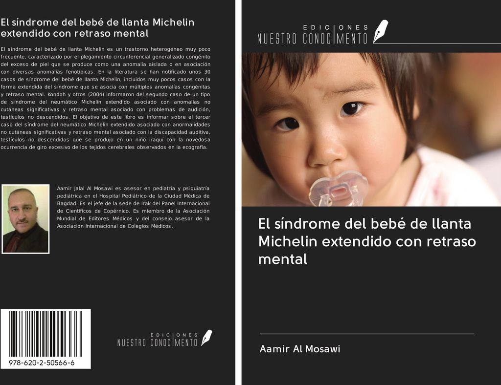 El síndrome del bebé de llanta Michelin extendido con retraso mental