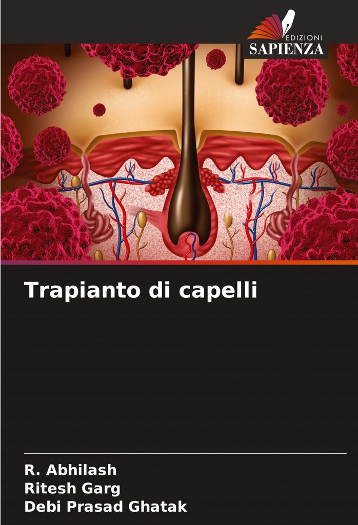 Trapianto di capelli