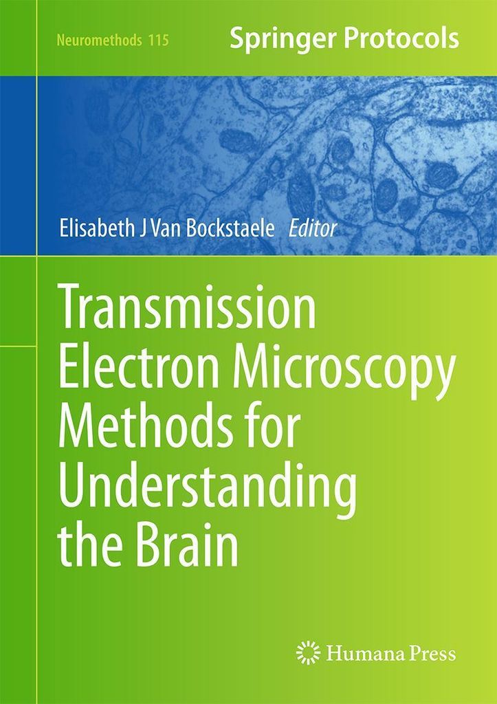 Transmission Electron Microscopy Methods for Understanding the Brain