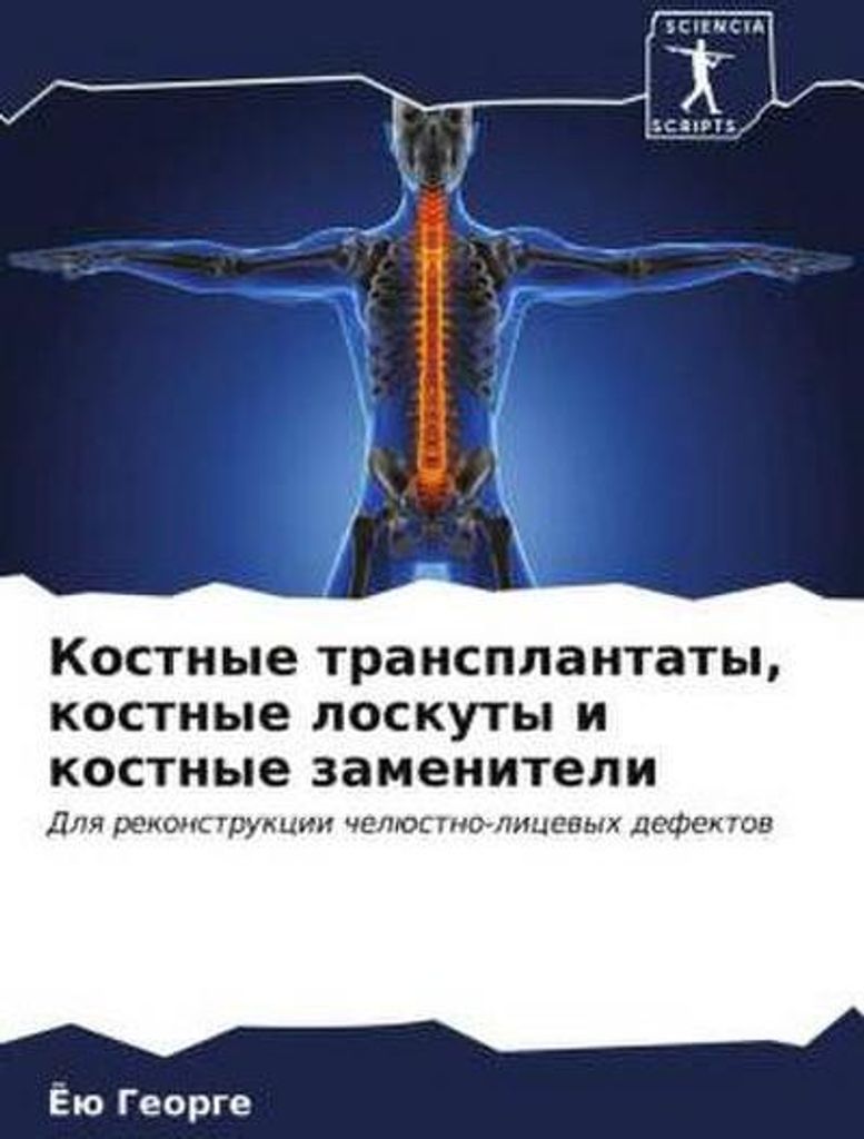 Kostnye transplantaty, kostnye loskuty i kostnye zameniteli