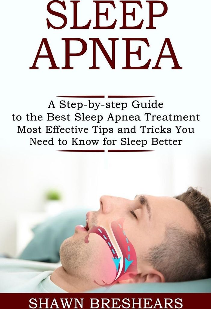 Sleep Apnea