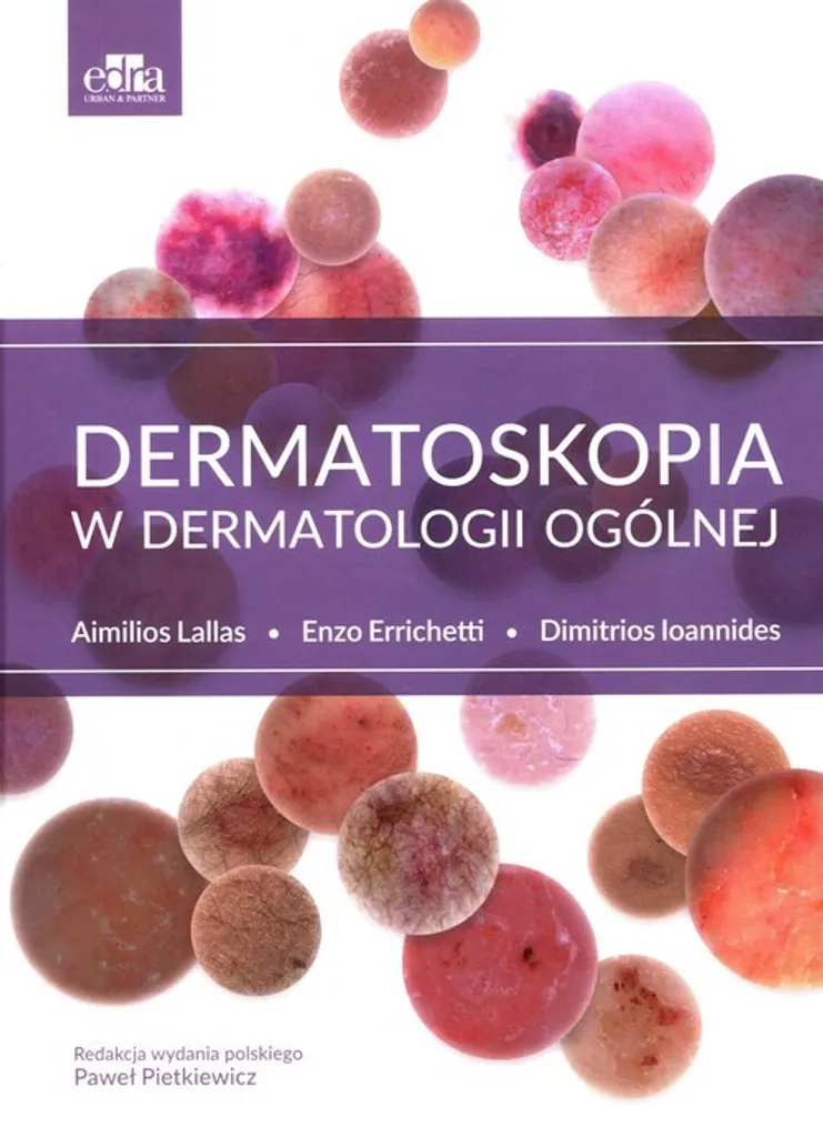 Livre Médical de Dermoscopie en Polonais : Dermatologie Générale Pratique