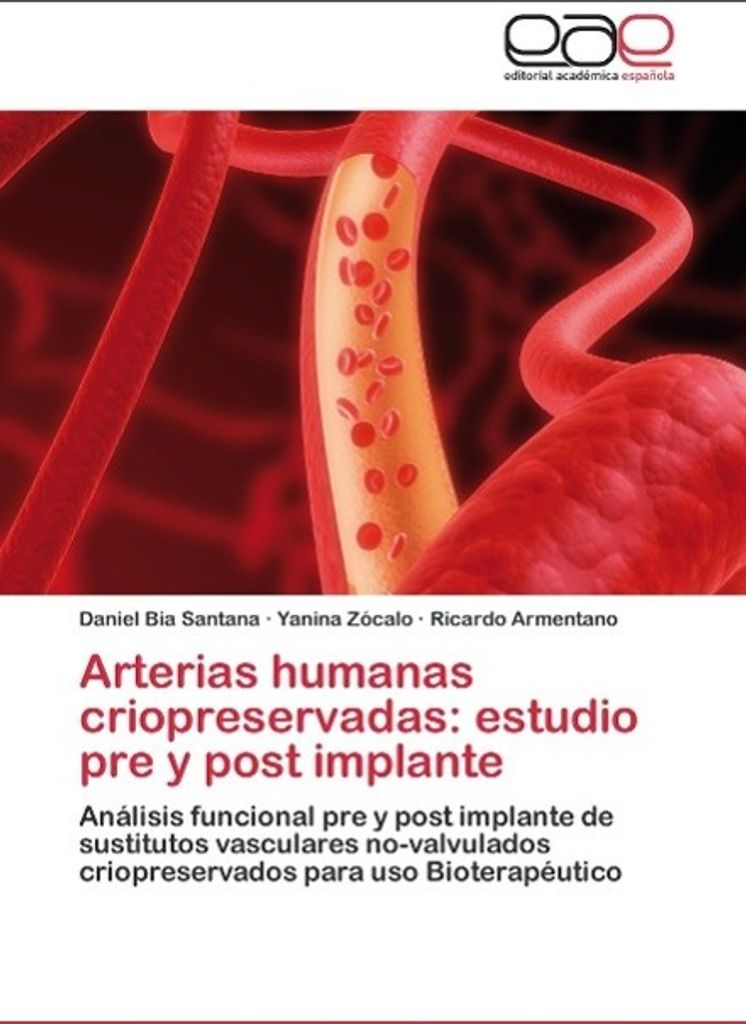 Arterias humanas criopreservadas: estudio pre y post Produktbild 