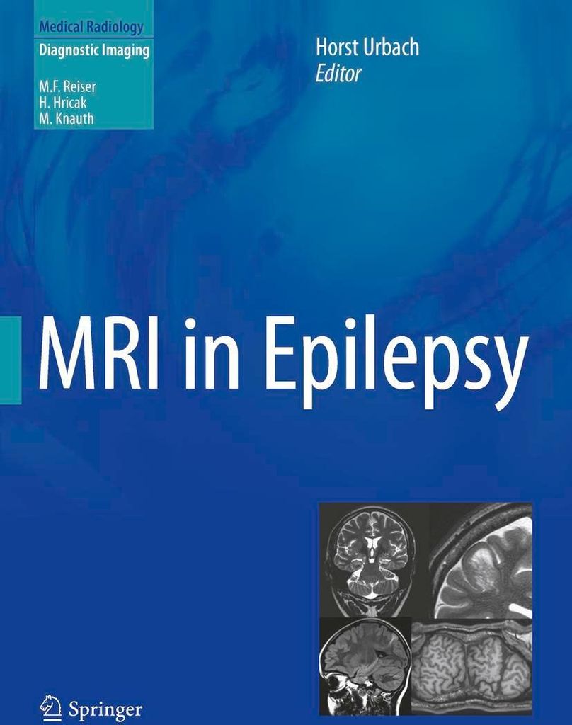 MRI in Epilepsy