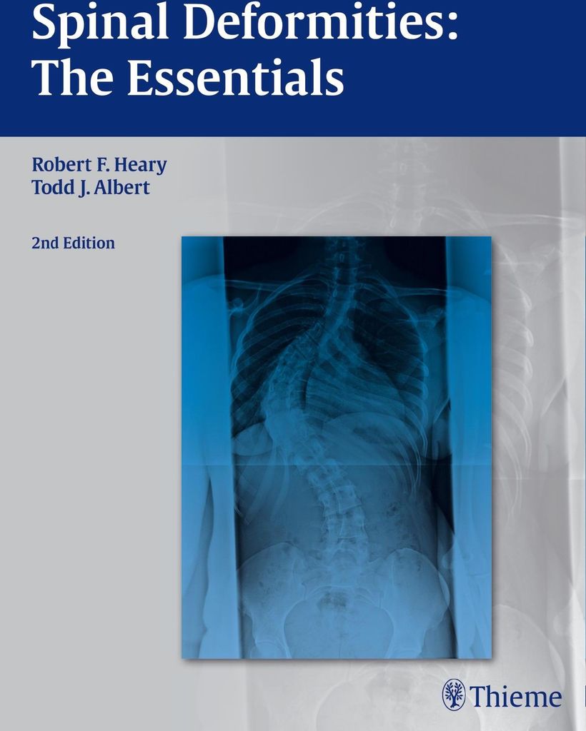 Spinal Deformities