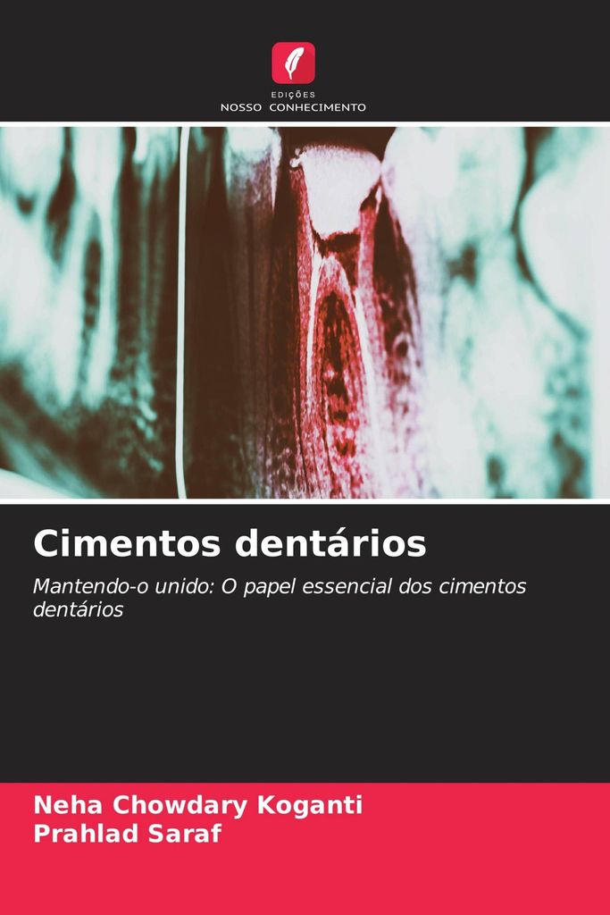 Cimentos dentários