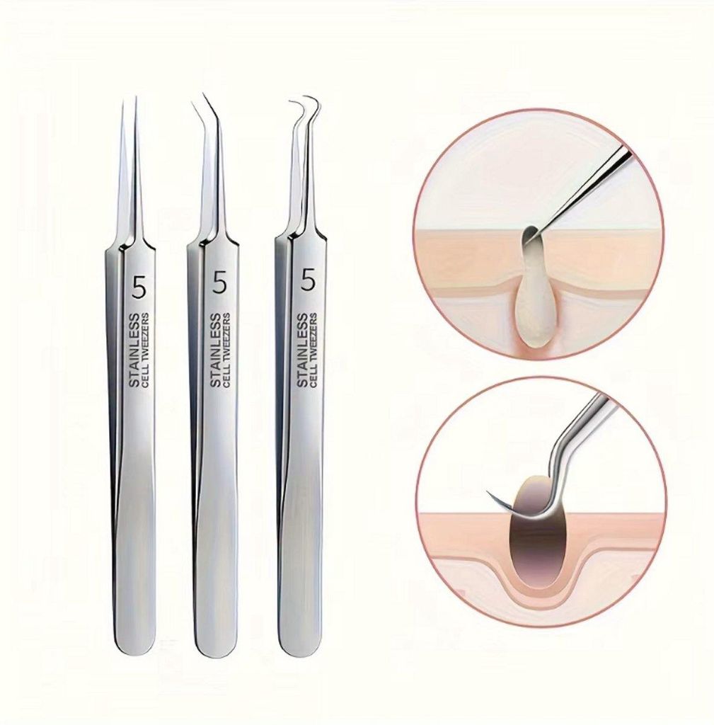 Mitesserentferner-Set – 3-teilig – 3-teilig – 3 Pinzetten – Produktbild 