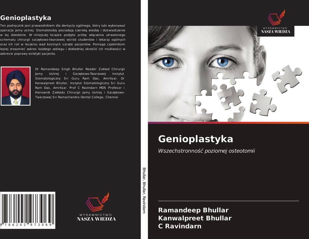 Genioplastyka