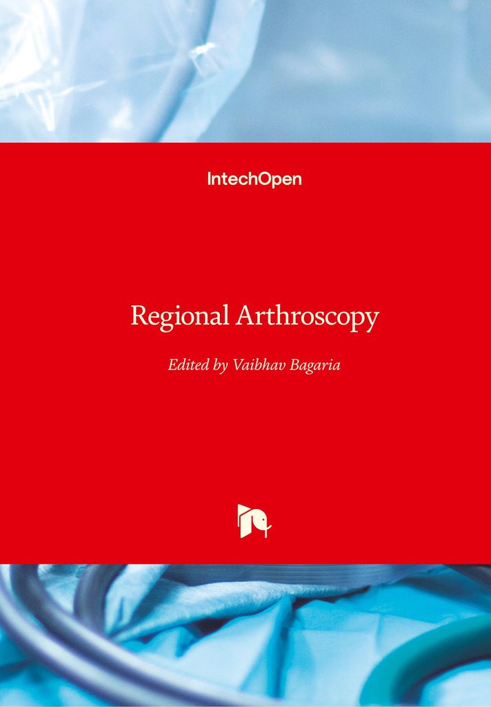Regional Arthroscopy