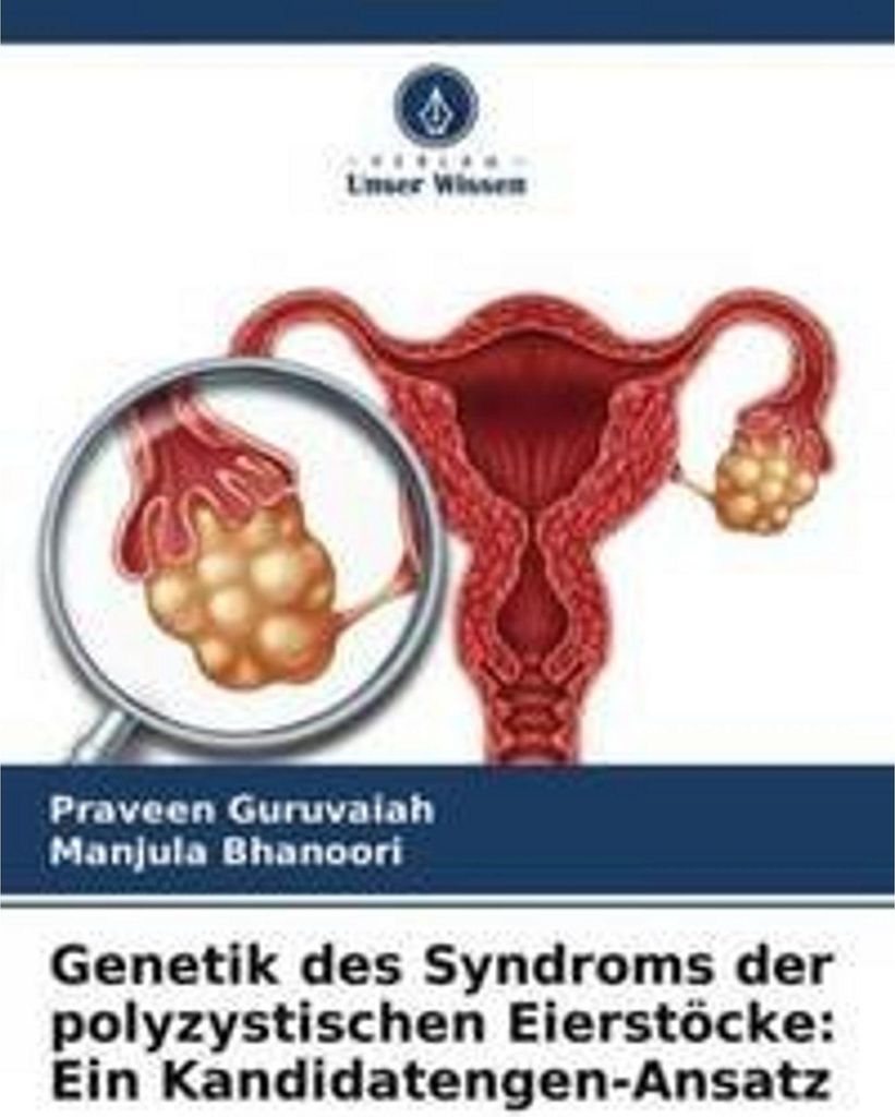 Genetik des Syndroms der polyzystischen Eierstöcke: Ein Kandidatengen-Ansatz