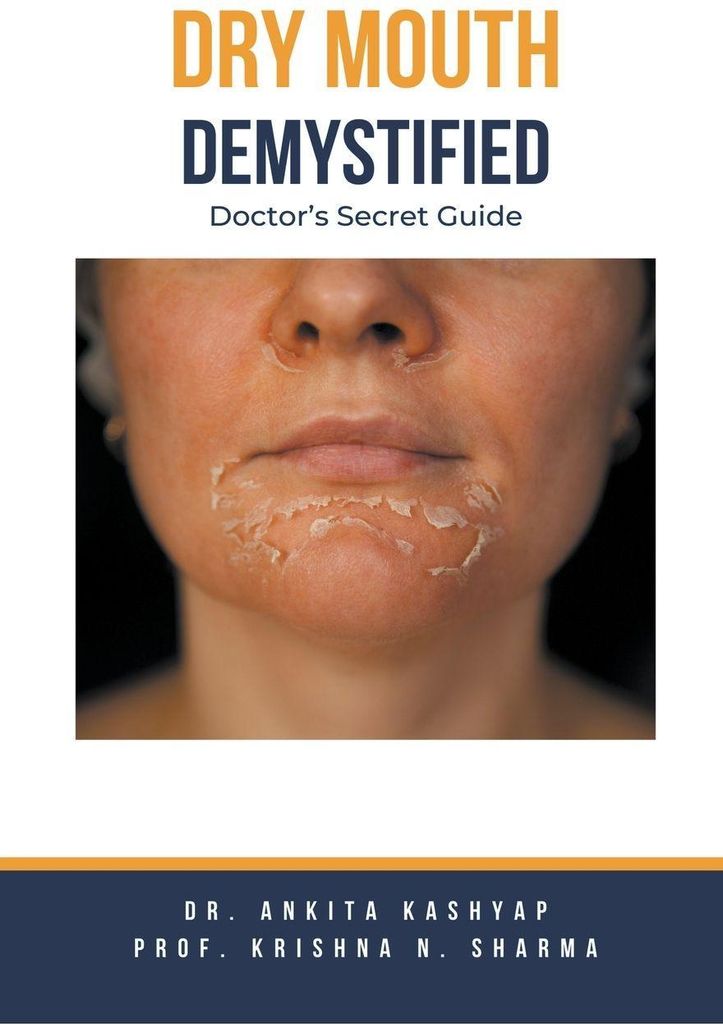 Dry mouth Demystified