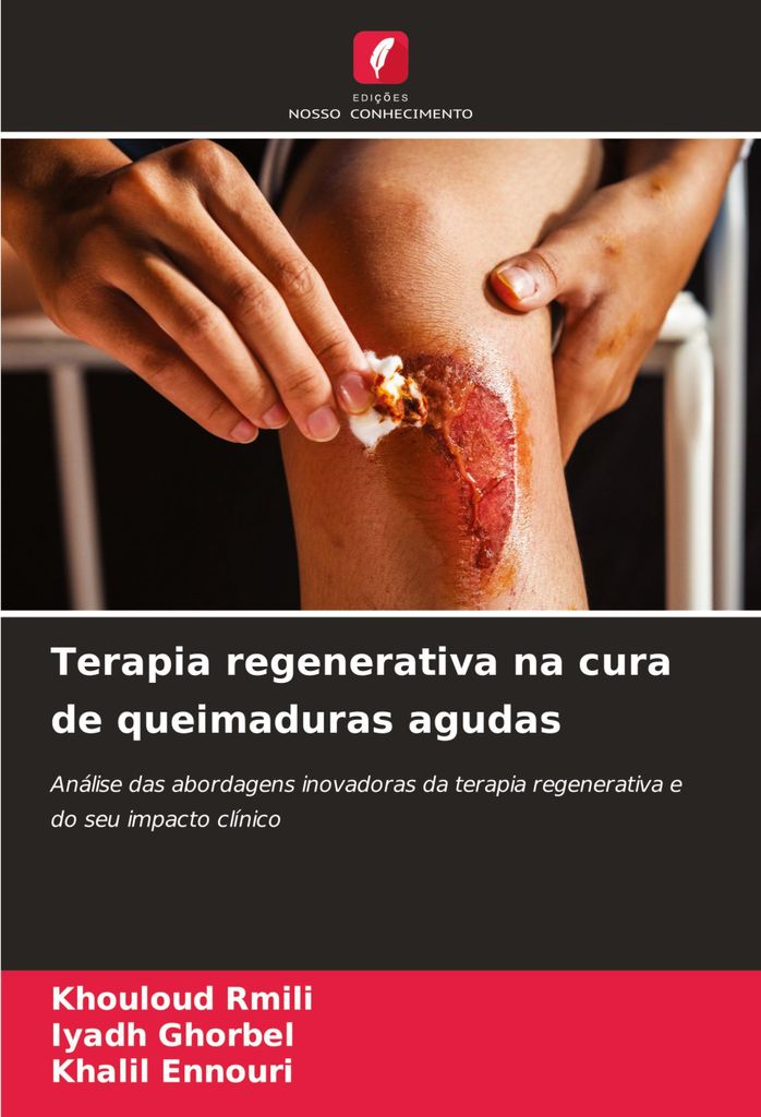 Terapia regenerativa na cura de queimaduras agudas