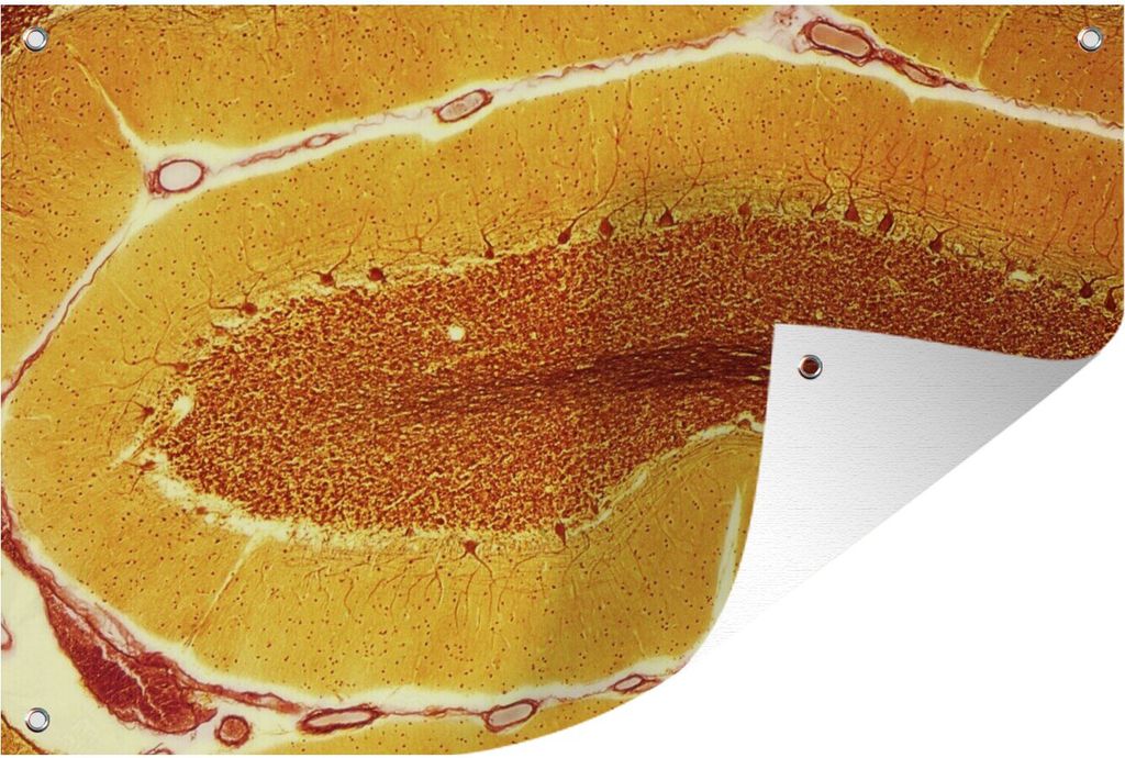 MuchoWow 90x60 cm Outdoor-Poster Gartendeko Sichtschutz Garten Poster für den Garten Orangefarbene Zellen in einem Nerv