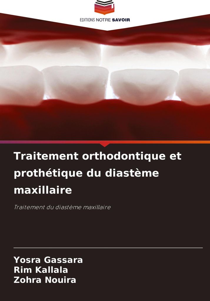 Traitement orthodontique et prothétique du diastème maxillaire